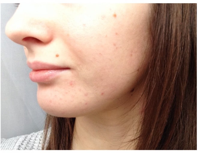 Тональный крем Diorskin Star от Dior в оттенке #020