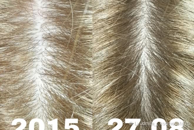 Победа над выпадением волос. Мой опыт с Brahmi Hair Oil от Vadik Herbs