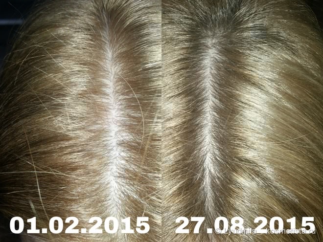 Победа над выпадением волос. Мой опыт с Brahmi Hair Oil от Vadik Herbs