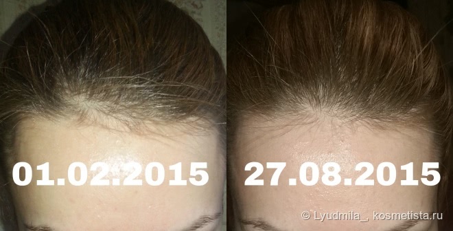 Победа над выпадением волос. Мой опыт с Brahmi Hair Oil от Vadik Herbs