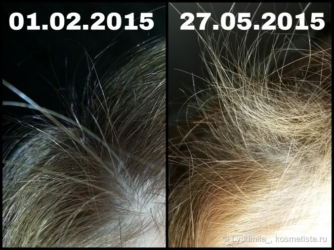 Победа над выпадением волос. Мой опыт с Brahmi Hair Oil от Vadik Herbs