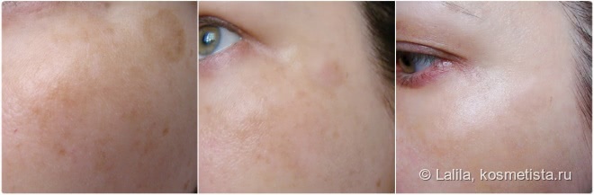 MartiDerm Kinetinol Crema-Gel