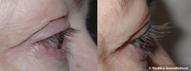 Двойной эксперимент с Almea Xlash Serum