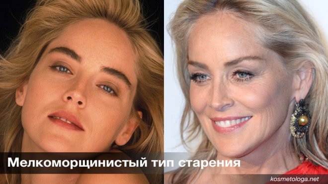 Морщины и складки - в чем разница?