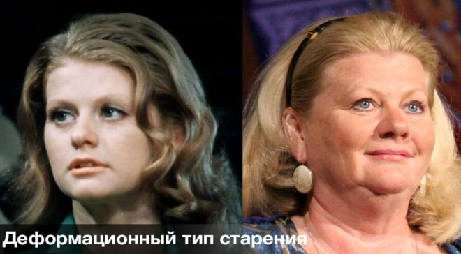 Морщины и складки - в чем разница?