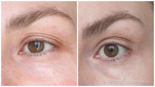 Skin Doctors EyeTuck - долой мешки и отеки