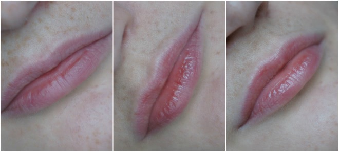 Alba Botanica, Fast Fix, for Thin Lips - Lip Plumper