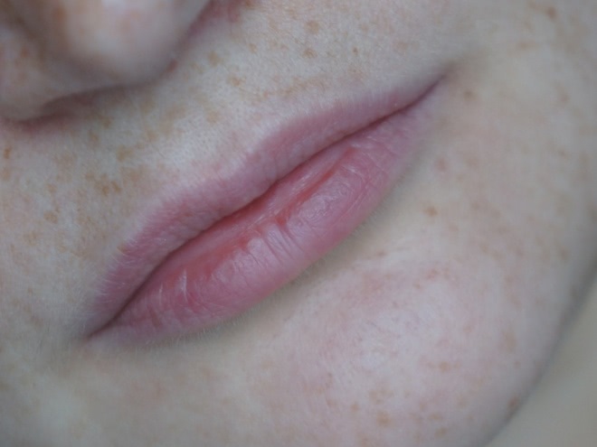 Alba Botanica, Fast Fix, for Thin Lips - Lip Plumper