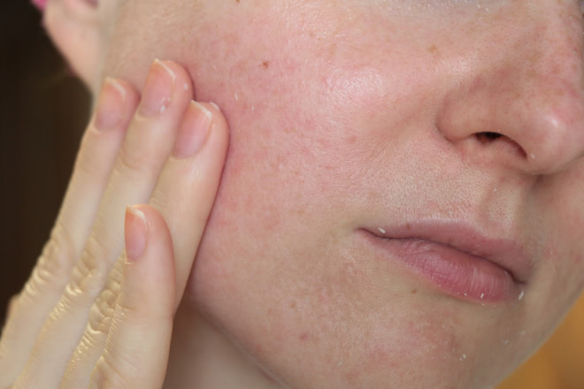 Непростые отношения: пилинг скатка Lioele Aroma Soft Peeling Gel