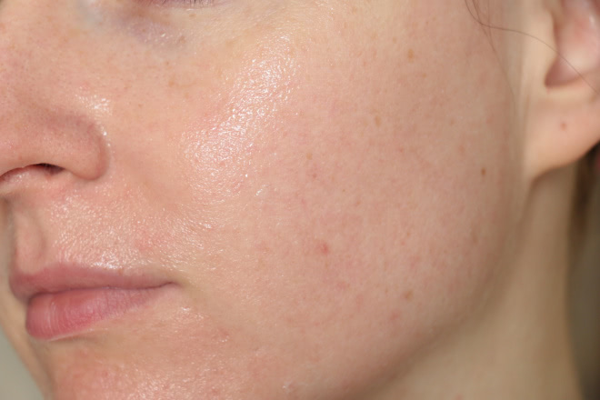 Непростые отношения: пилинг скатка Lioele Aroma Soft Peeling Gel