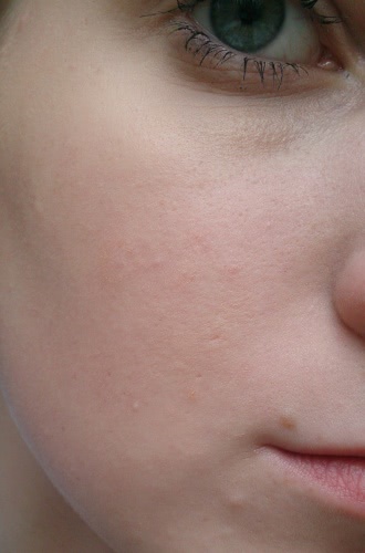 Бюджетная находка от Dr. Kirov Cosmecic Company СЛЕДОЦИД тональный Антикомедогенный ВВ крем-гель