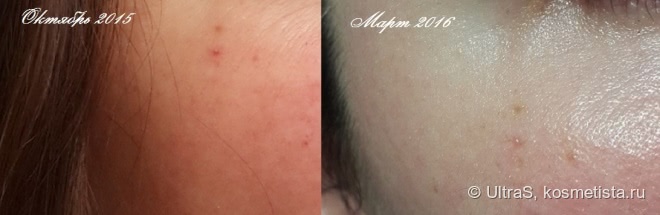 Просто чудо, а не масло A'kin pure radiance rosehip oil - certified organic + фото результата использования