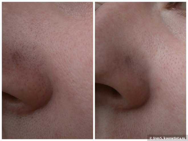 Чистим поры от черных точек с помощью Ciracle Pore Control Blackhead Off Sheet