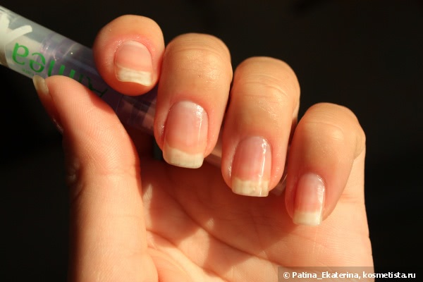 Almea Xnail