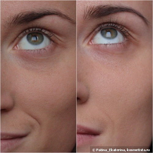 Almea Eyelash Serum Xlash