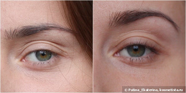 Almea Eyelash Serum Xlash