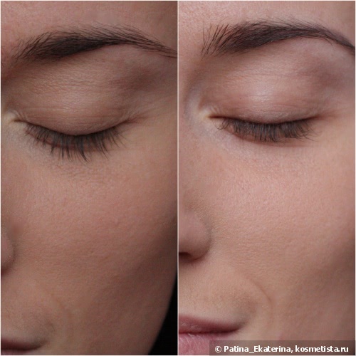 Almea Eyelash Serum Xlash