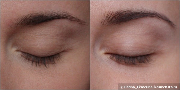 Almea Eyelash Serum Xlash