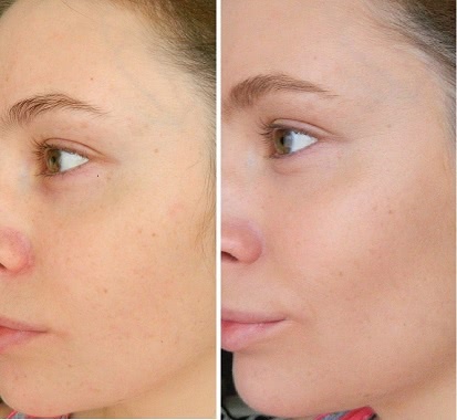 Chanel Vitalumiere Aqua Ultra Light Skin Perfecting Makeup SPF 15 оттенок 32 Beige rose