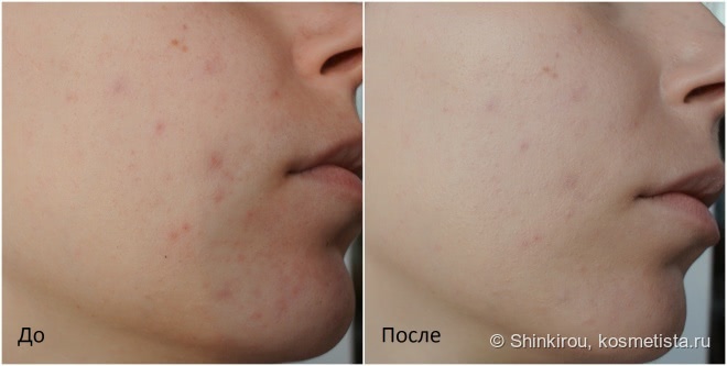 Missha: M Signature Real Complete B.B Cream Spf25/pa++ №21 и M Prism Glow Powder Pact Spf36/pa++ №23 + Гидрофильное масло Perfect BB Deep Cleansing Oil