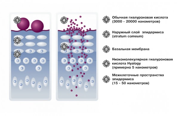Низкомолекулярная гиалуроновая кислота ONmacabim L.r.n. Solution 3,2 % и мезороллер MT Microneedle Therapy system
