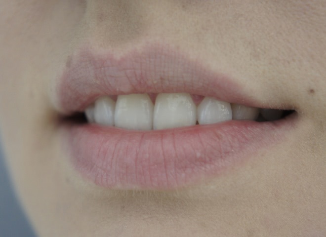 Не сложилось с Chanel Levres Scintillantes Glossimer Brilliant Extreme, в оттенке #161