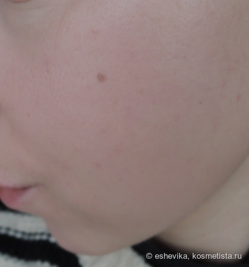 Anti-Blemish Solutions BB Cream Spf40 От Clinique