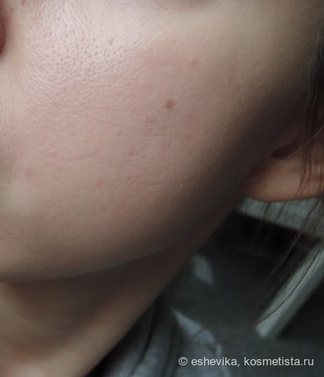 Anti-Blemish Solutions BB Cream Spf40 От Clinique