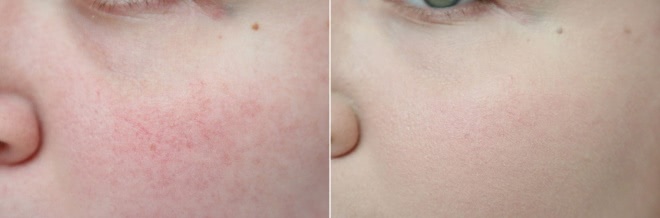 Lumene Longwear Blur SPF 15 Powder & Foundation