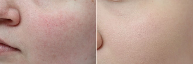 Lumene Longwear Blur SPF 15 Powder & Foundation