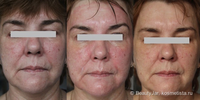 30 VS 50: двойной эксперимент пептидной маски Elysien Multi EX-Lifting. Сужение пор, разглаживание, лифтинг?