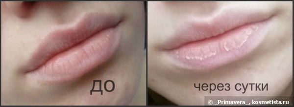 Бальзам для губ Blistex Lip Medex External Analgesic Lip Protectant