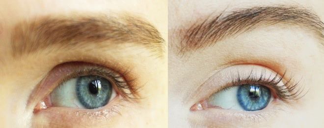 Зачем наращивать ресницы, если можно отрастить свои с Xlash Eyelash Serum от Almea?! (фото до и после)