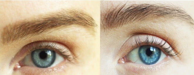 Зачем наращивать ресницы, если можно отрастить свои с Xlash Eyelash Serum от Almea?! (фото до и после)