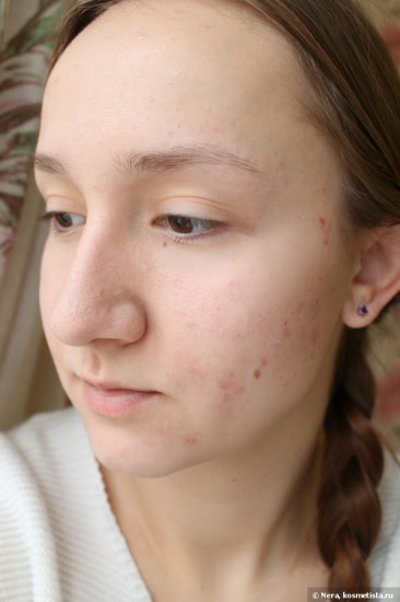 Три средства La Roche-Posay против несовершенств