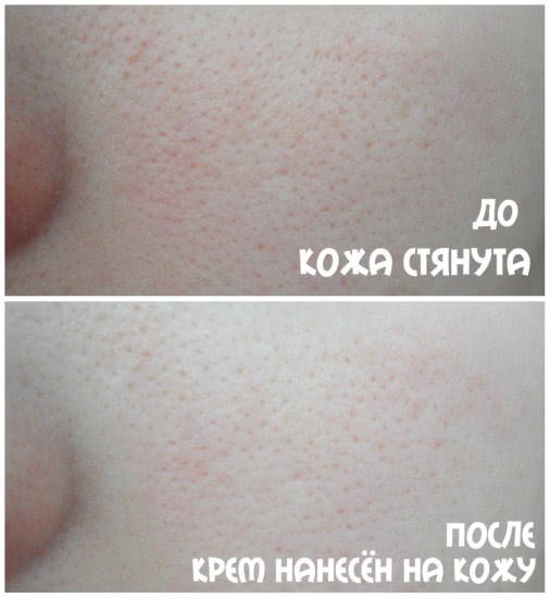Парочка от Noreva Exfoliac. Борцы с несовершенствами кожи, которые не справились