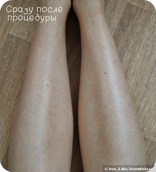 У меня стала идеальная кожа У меня стала идеальная кожа