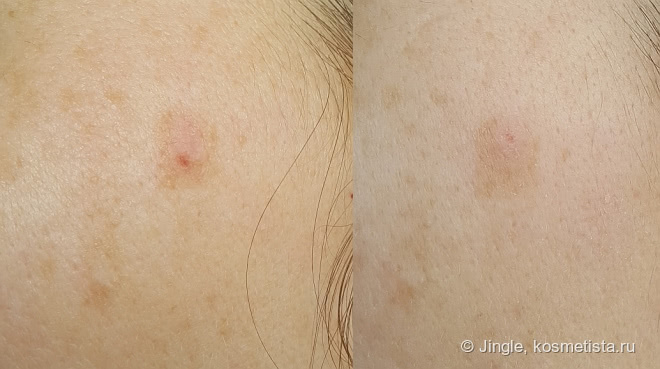 White Objective Sérum Bioderma. Осветляющая ночная сыворотка