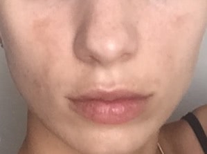 Моя борьба с пигментацией при помощи косметики Image Skincare