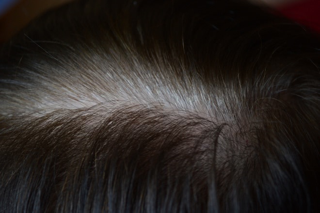 Пудра для камуфляжа Minox Hair Magic. Припудрим седину