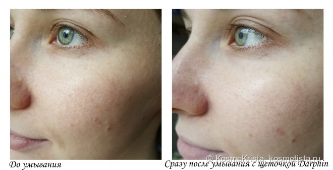 Darphin L’Institut Facial Sonic Cleansing and Massaging Expert прибор для массажа и очищения лица