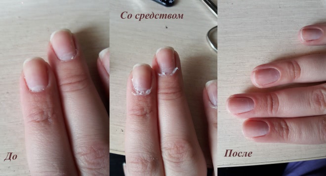 Avon Advanced mira-cuticle vanishing complex