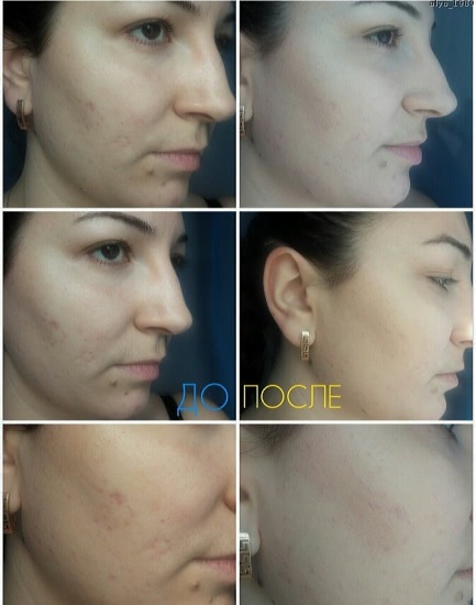 Люблю нежной любовью. Artdeco Hydra Mineral Compact Foundation - минерализированная пудра