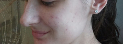 Идеальный Bb-Крем для проблемной кожи – Tony Moly AC control BB cream