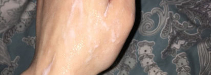 Bioderma DS+ моё спасение?