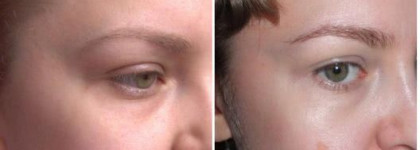 Chanel Précision, performance anti-taches – роликовый корректор пигментных пятен