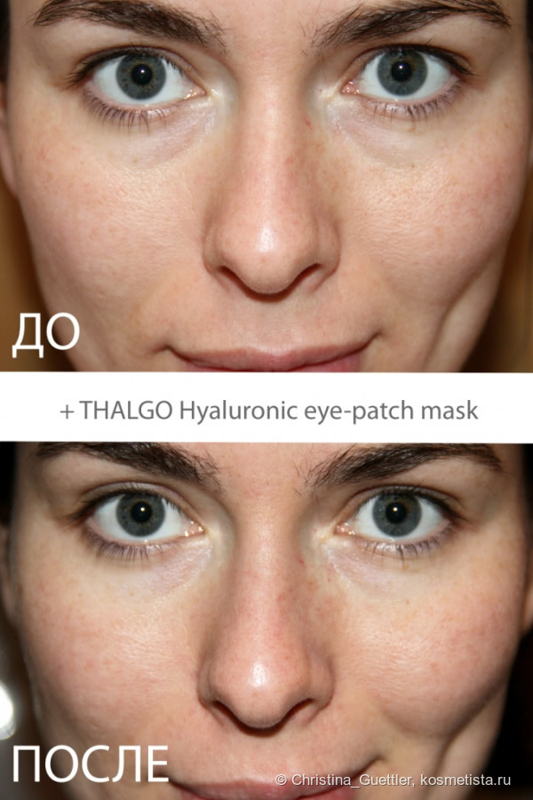 Thalgo гиалуроновая маска патч для кожи вокруг глаз