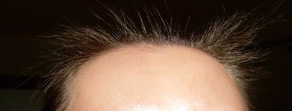 Коллистар ампулы для волос для роста волос