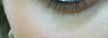 Полгода из жизни моей кожи