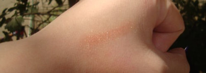 Мой рыжий урожай 2010